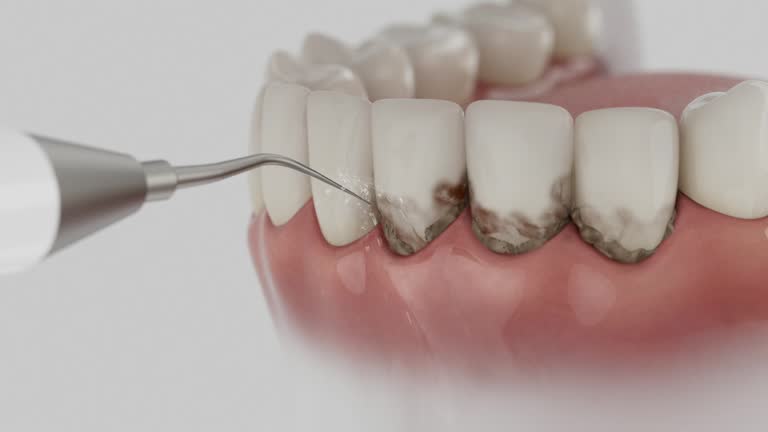 Reliable Dental Implants contractor in Prospect, KY by Smile Center Dentistry